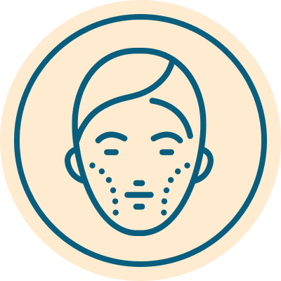 Lactobacillus paracasei